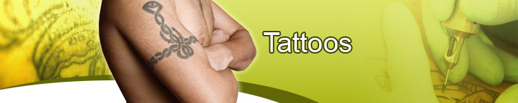 Tattoo Removal at Tattoos